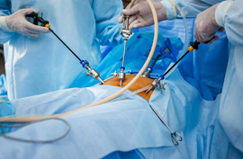 Laparoscopic Surgery